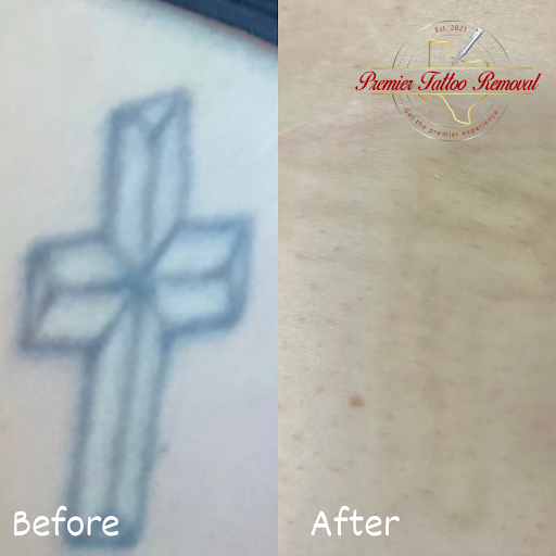 Explore back tattoo ideas for females, creative tattoo ideas in Mckinney, available at Premier Tattoo Removal