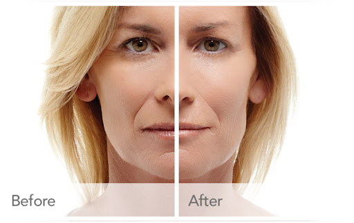 Zormeier Cosmetic Surgery and Longevity Center image