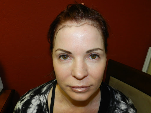 Medical Hair Transplant & Aesthetics image