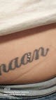 Exed-ink - Tattoo Removal Nottingham