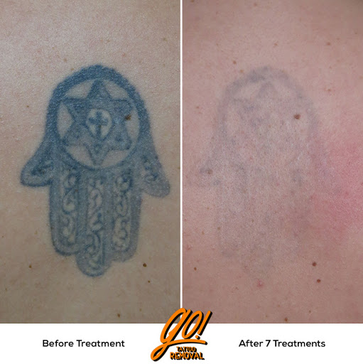 Explore underarm tattoo ideas, creative tattoo ideas in Allentown, available at Removery Tattoo Removal & Fading