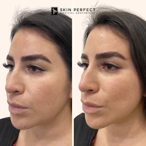 Explore lion tattoo ideas for guys, creative tattoo ideas in Whittier, available at Skin Perfect Medical Aesthetics