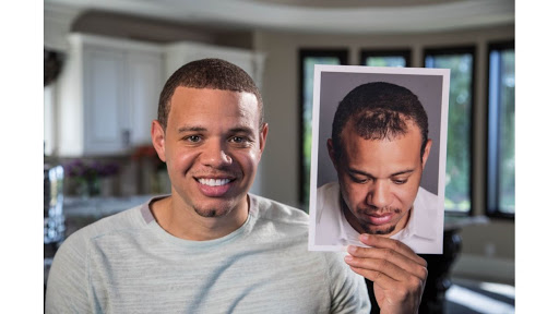 Hair Transplantation Clinic «Bosley Medical - Minneapolis», reviews and photos, 12455 Ridgedale Dr #204, Minnetonka, MN 55305, USA