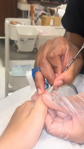 O beauty salon - خدمة إزالة الشعر بالليزر