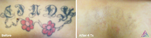 Explore photography tattoo ideas, creative tattoo ideas in Fort Myers, available at Laser Tattoo Removal by Tatt Cemetery