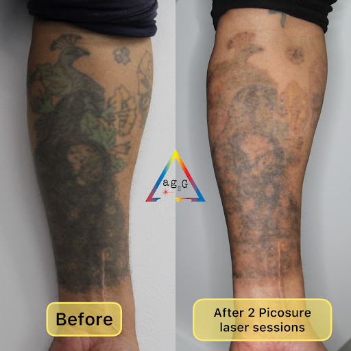 Explore bodybuilding tattoos ideas, creative tattoo ideas in New York, available at Ag2g Laser Tattoo Removal & MedSpa
