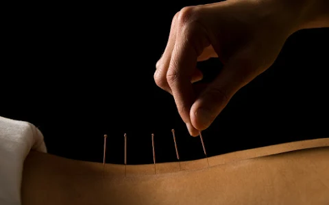 Acupuncture - Isabelle Deblois image