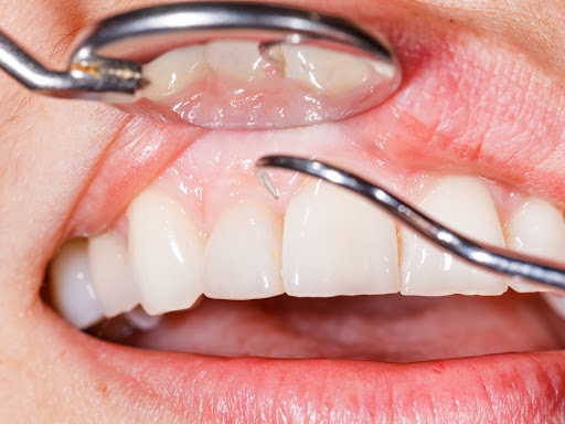 Kellen Tadano DDS, PC - Carlsbad Dentist