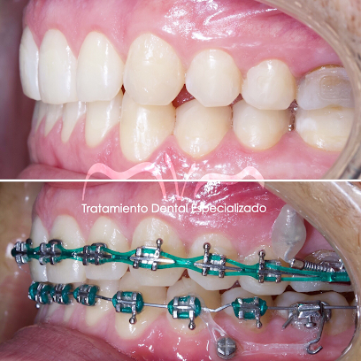 Ortodoncia MVM - Tratamiento Dental Especializado