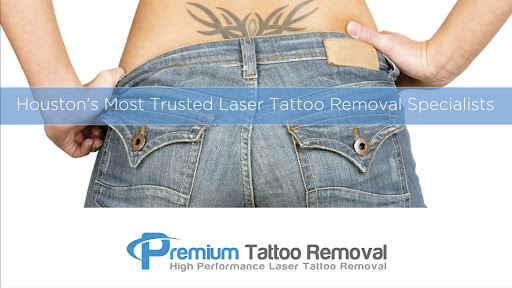 Explore lizard tattoo ideas, creative tattoo ideas in Houston, available at Premium Tattoo Removal