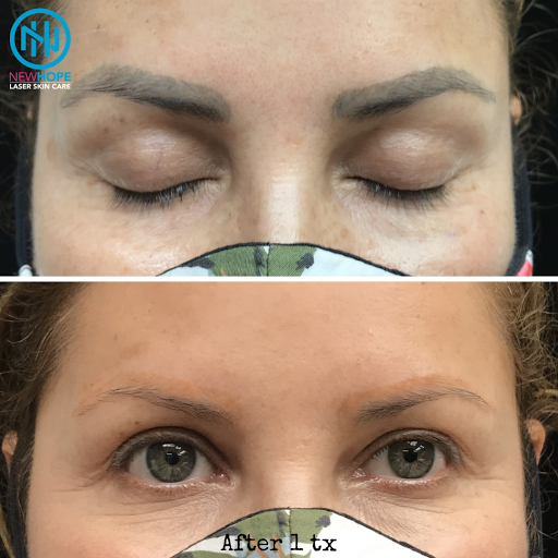 Explore cute finger tattoo ideas, creative tattoo ideas in Westminster, available at Newhope Laser Skin Care