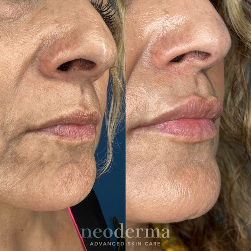 Explore arkansas tattoo ideas, creative tattoo ideas in Anaheim, available at Neoderma