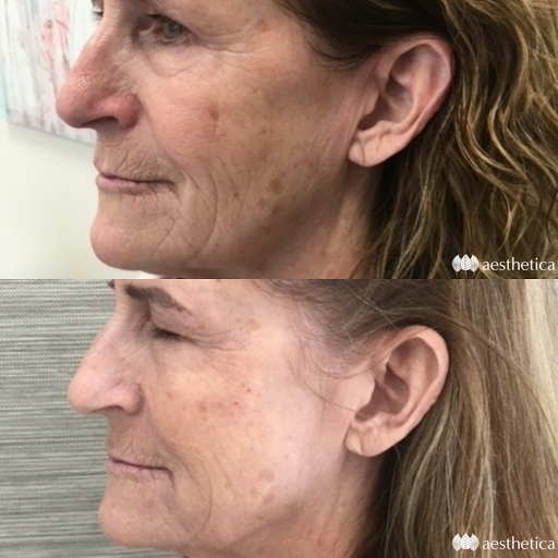 Explore kiss lip tattoo ideas, creative tattoo ideas in Pleasant Grove, available at Aesthetica