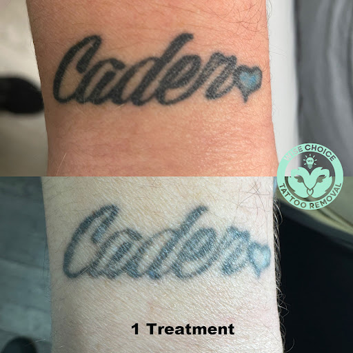 Explore footprints poem tattoo ideas, creative tattoo ideas in Denver, available at Wise Choice Tattoo Removal