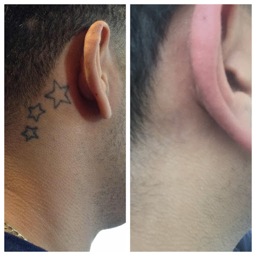 Explore forearm tattoo filler ideas, creative tattoo ideas in Lawrence, available at Removery Tattoo Removal & Fading