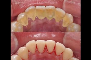 Jain dental care Best Oral, Maxillofacial Surgeon in Dewas, Facial Trauma Surgery , Dental Implant in Dewas, Dentist in Dewas image