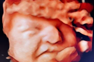 Baby Bump Prenatal Imaging, LLC image