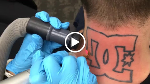 Explore neck and shoulder tattoo ideas, creative tattoo ideas in Conroe, available at Removery Tattoo Removal & Fading