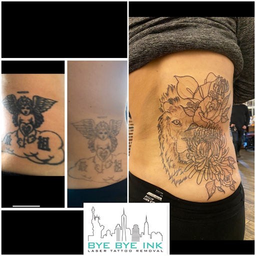 Explore tattoo stencils ideas, creative tattoo ideas in Middle Village, available at Bye Bye Ink Laser Tattoo Removal