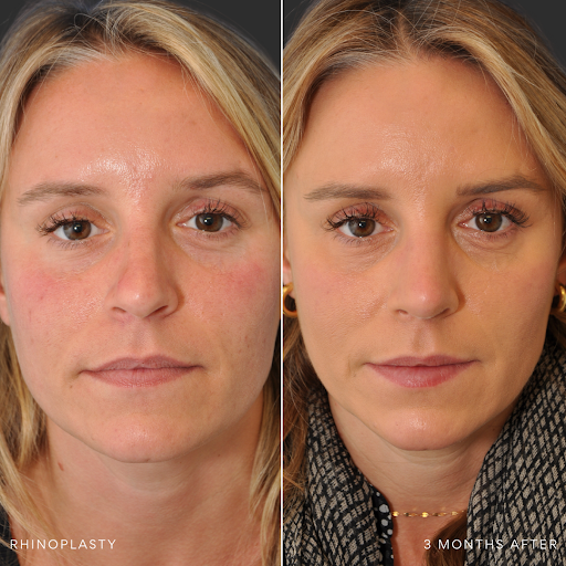 Edward S. Kwak MD - ESKMD Facial Plastic Surgery