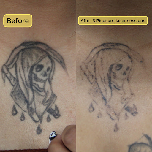 Explore river tattoo ideas, creative tattoo ideas in New York, available at Ag2g Laser Tattoo Removal & MedSpa