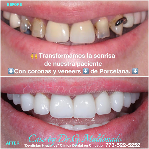 Dentistas Hispanos