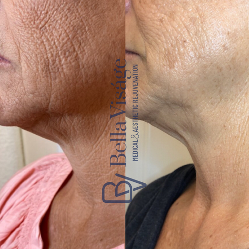 Explore leopard print tattoo ideas, creative tattoo ideas in Lakeland, available at Bella Visge Medical & Aesthetic Rejuvenation