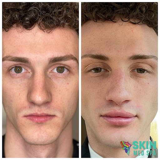 Explore long skinny tattoo ideas, creative tattoo ideas in Downers Grove, available at Skin Med Spa