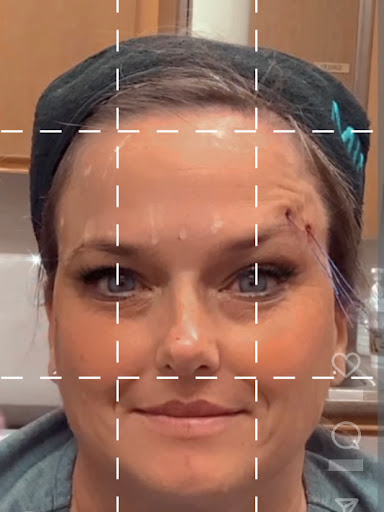 Explore thigh cover up tattoo ideas, creative tattoo ideas in Lake Oswego, available at Lake Oswego Vein and Aesthetic LOVA