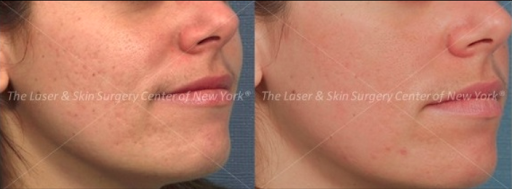 Explore great meaningful tattoo ideas, creative tattoo ideas in New York, available at Laser & Skin Surgery Center
