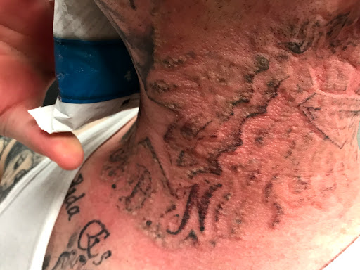 Find wolf tattoo ideas for your next unique tattoo in Dallas at Dallas Tattoo Removal Clinic