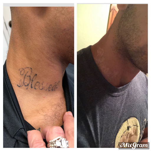 Explore tattoo idea legs, creative tattoo ideas in Longview, available at Vanish Laser Aesthetics