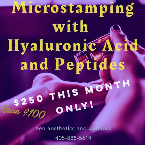 Explore cherry tattoo ideas, creative tattoo ideas in Edmond, available at Zen Aesthetics & Wellness Medical Spa