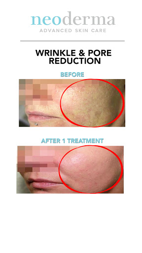 Find tattoo ideas mom for your next unique tattoo in Anaheim at Neoderma