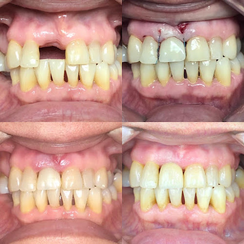 Opiniones de Clínica Cruces en Mariquina - Dentista