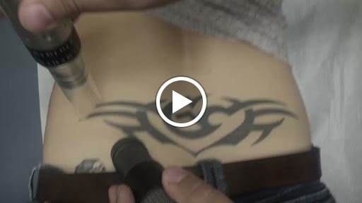 Explore inner elbow tattoo ideas, creative tattoo ideas in Heath, available at TakeTatt Tattoo Removal