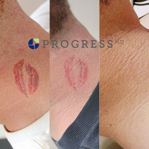 Explore asian tattoo ideas, creative tattoo ideas in Amarillo, available at Progress MD Tattoo Removal