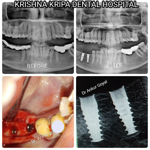 Shree Krishana Kripa Multispeciality Dental Clinic- Best Dental Clinic in Jaipur | Best Dental Implan Treatment | Best Dentist in Jaipur