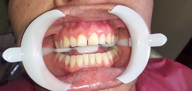 Opiniones de CONSULTORIO ODONTOLÓGICO Odonto SERT en Guano - Dentista
