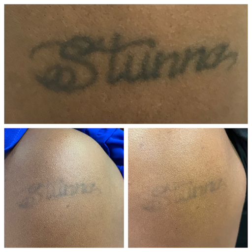 Explore memorial tattoo ideas for friend, creative tattoo ideas in Allen, available at Shipers Laser Tattoo Removal Center Dallas