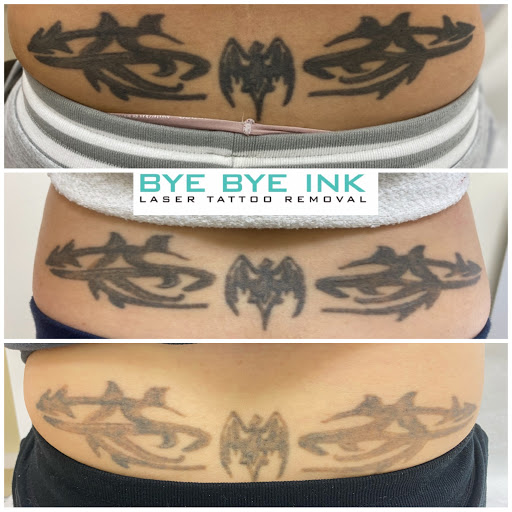 Explore unique water tattoo ideas, creative tattoo ideas in Middle Village, available at Bye Bye Ink Laser Tattoo Removal