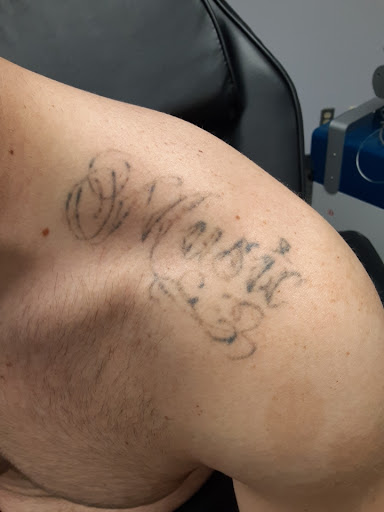 Explore tattoo matching ideas, creative tattoo ideas in Saint Paul, available at Fearless Tattoo Removal