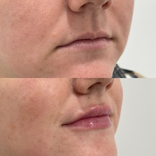 Explore quad tattoo ideas, creative tattoo ideas in Owensboro, available at The Skin Lab