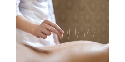 acupuncture traditionnelle chinoise pilonchery thibaut à Albertville