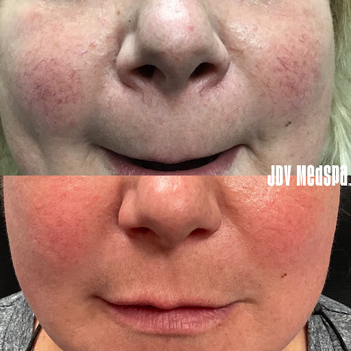 Find stars tattoo ideas for your next unique tattoo in Canton at JDV Med Spa