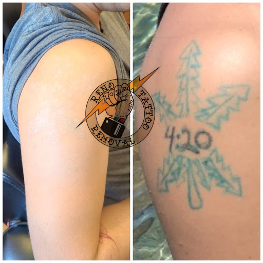 Explore calligraphy tattoo ideas, creative tattoo ideas in Reno, available at Reno Tattoo Removal