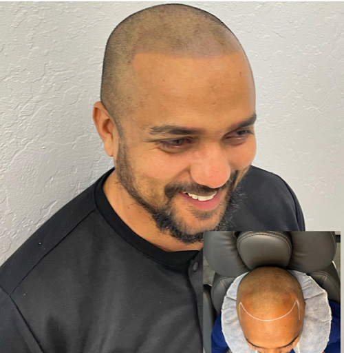 Explore lana del rey tattoo ideas, creative tattoo ideas in Roseville, available at NuHair Ink. Scalp MicroPigmentation & Aesthetic Clinic of Sacramento