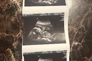 Ultrasona Fetal Fotos image