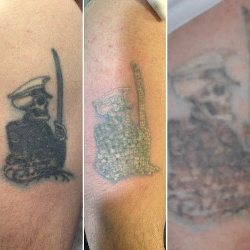 Explore tattoo ideas eays, creative tattoo ideas in Morrisville, available at Regerts Ink Removal