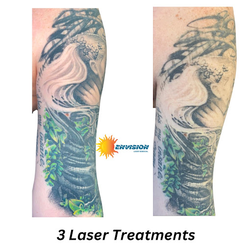 Explore tattoo ideas amsterdam, creative tattoo ideas in Port Charlotte, available at Envision Laser Removal
